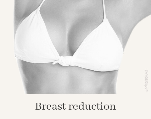 Breast Reduction, Difine, Dr. Narwan, Plastic Surgery, Essen 